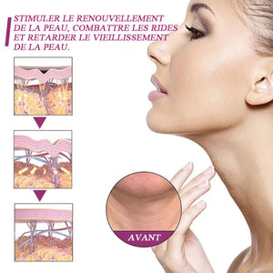 Crème pour le cou au collagène hydrolysé [Achetez 1 obtenez 1 gratuitement (2 pièces)]