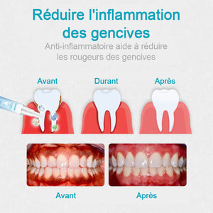 Gel de réparation pour les dents (Achetez 1 obtenez 1 gratuitement)