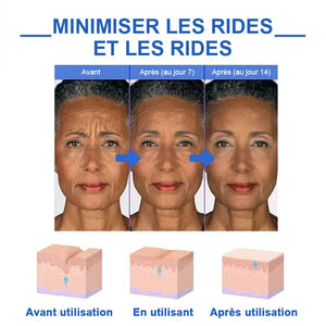 Essence B5 raffermissante et anti-rides