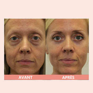 Crème réparatrice pour les yeux au peptide rétinol