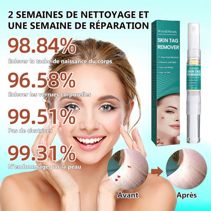 Sérum d'élimination d'étiquettes grains de beauté (3 pièces)