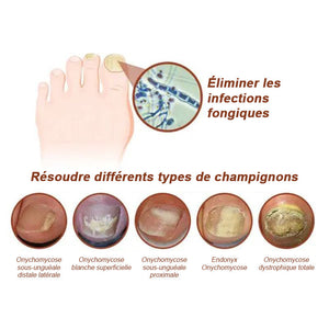 Sérum pour la croissance et le renforcement des ongles