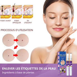 Stylo anti-acrochordons retirer des étiquettes de peau (2 pièces)