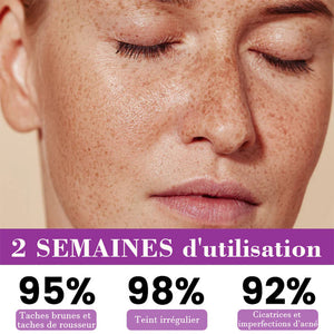 Sérum anti-pigmentation avancé