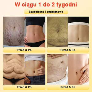 Modelujące spodenki z tytanu i turmalinu