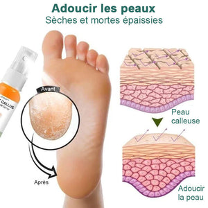 Spray pour éliminer les callosités des pieds (2 bouteilles)