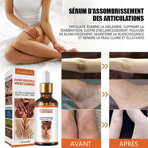 SÉRUM BLANCHISSANT POUR LES JOINTURES SOMBRES