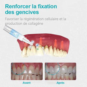 Gel de réparation pour les dents (Achetez 1 obtenez 1 gratuitement)