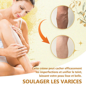 Crème de soin pour varices