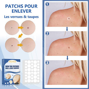 Patchs pour enlever les verrues et les taupes (Achetez 1 en obtenez 1 gratuitement)