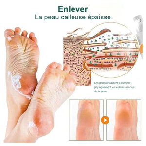 Spray pour éliminer les callosités des pieds (2 bouteilles)