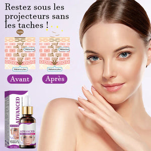 Sérum anti-pigmentation avancé