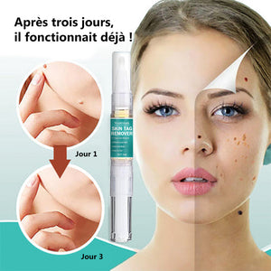 Sérum d'élimination d'étiquettes grains de beauté (3 pièces)