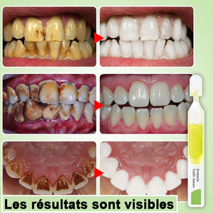 Sérum de blanchiment des dents éliminer les taches et blanchir les dents