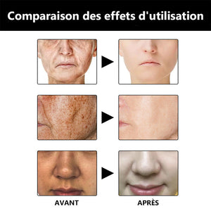 Sérum de réparation la mélanine de visage