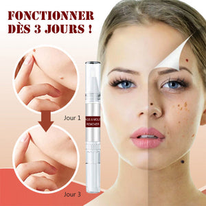 Essence d'enlever grains de beauté et des taches (2 pièces)