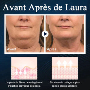 Appareil de beauté du visage en V endormi