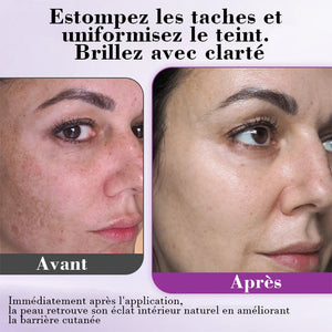 Sérum anti-pigmentation avancé