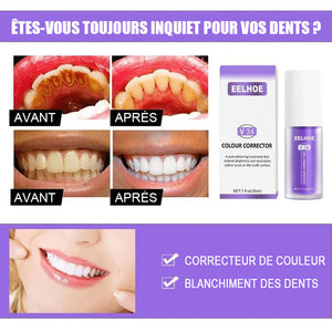 Mousse de blanchiment des dents à base de plantes de luxe