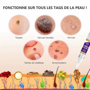 Stylo anti-acrochordons retirer des étiquettes de peau (2 pièces)