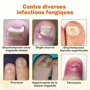 Spray réparateur d'ongles au venin d'abeille