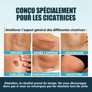 Gel pour l'élimination des cicatrices Atténuer les taches sombres