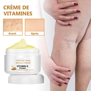 Crème de soin pour varices