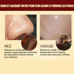 Masque peel-off pour enlever les points noirs