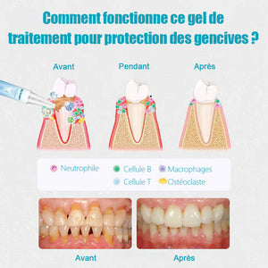 Gel de réparation pour les dents (Achetez 1 obtenez 1 gratuitement)